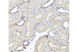 Immunohistochemistry of paraffin-embedded Mouse kidney using OPRK1 Polyclonal Antibody at dilution of 1:100 (40x lens). (OPRK1 Antikörper)