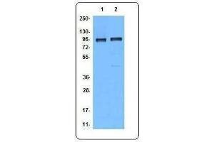 Western Blotting (WB) image for anti-B-Cell CLL/lymphoma 6 (BCL6) antibody (ABIN2664064) (BCL6 Antikörper)