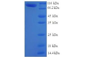 SDS-PAGE (SDS) image for Myotubularin Related Protein 7 (MTMR7) (AA 1-660), (full length) protein (His-SUMO Tag) (ABIN4975885) (MTMR7 Protein (AA 1-660, full length) (His-SUMO Tag))