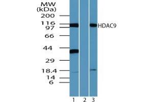 Image no. 2 for anti-Histone Deacetylase 9 (HDAC9) (AA 100-150) antibody (ABIN960197) (HDAC9 Antikörper  (AA 100-150))