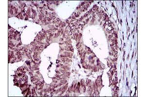 Immunohistochemistry (IHC) image for anti-Zinc Finger E-Box Binding Homeobox 1 (ZEB1) (AA 967-1108) antibody (ABIN1724885)