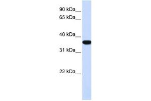 Heme Oxygenase antibody used at 1 ug/ml to detect target protein. (Heme Oxygenase Antikörper)