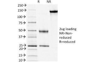 SDS-PAGE Analysis Purified CD3e Mouse Monoclonal Antibody (PC3/188A). (CD3 epsilon Antikörper  (Cytoplasmic Domain))