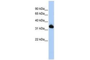 Image no. 1 for anti-Galactose Mutarotase (Aldose 1-Epimerase) (GALM) (AA 36-85) antibody (ABIN6741152)