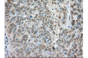 Immunohistochemical staining of paraffin-embedded colon tissue using anti-TACC3 mouse monoclonal antibody.