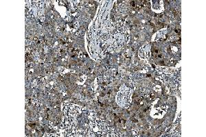 IHC analysis of SEC14L3/TAP2 using anti-SEC14L3/TAP2 antibody (ABIN7601623). (SEC14L3 Antikörper  (AA 4-400))