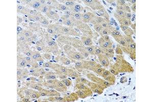 Immunohistochemistry of paraffin-embedded Human liver using ARSF Polyclonal Antibody at dilution of 1:100 (40x lens). (ARSF Antikörper)
