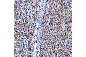 IHC analysis of RAB7/RAB7A using anti-RAB7/RAB7A antibody (ABIN7600597).