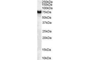 ABIN2562711 (1µg/ml) staining of human pancreas lysate (35µg protein in RIPA buffer).