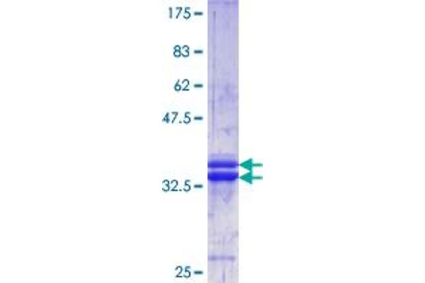 COL1A1 Protein (AA 1021-1108) (GST tag)