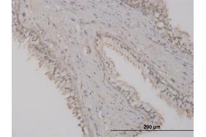 Immunoperoxidase of monoclonal antibody to ST8SIA2 on formalin-fixed paraffin-embedded human prostate. (ST8SIA2 Antikörper  (AA 40-146))