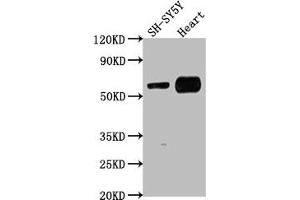 Western Blot Positive WB detected in: SH-SY5Y whole cell lysate, Mouse heart tissue All lanes: JRK antibody at 1:1000 Secondary Goat polyclonal to rabbit IgG at 1/50000 dilution Predicted band size: 62, 63 kDa Observed band size: 62 kDa (JRK Antikörper  (AA 465-483))
