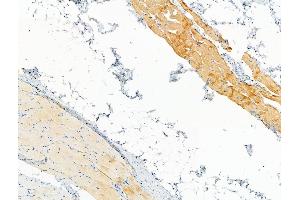 Phospho-ASK1 (Ser1033) Antibody at 1/100 staining Rat skin tissue by IHC-P.