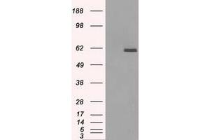 Image no. 1 for anti-Protein Phosphatase 5, Catalytic Subunit (PPP5C) antibody (ABIN1500392)