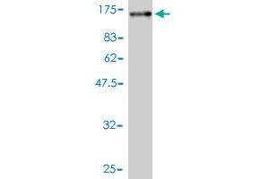 Western Blot detection against Immunogen (98. (RALBP1 Antikörper  (AA 1-655))