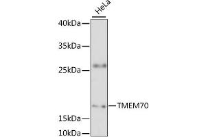 Western blot analysis of extracts of HeLa cells, using TMEM70 antibody (ABIN6294170) at 1:3000 dilution. (Transmembrane Protein 70 (TMM70) Antikörper)