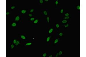 Immunofluorescent analysis of Hela cells using ABIN7142846 at dilution of 1:100 and Alexa Fluor 488-congugated AffiniPure Goat Anti-Rabbit IgG(H+L) (NIP7 Antikörper  (AA 1-180))