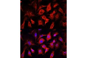 Immunofluorescence analysis of NIH/3T3 cells using ENO2 antibody. (ENO2/NSE Antikörper  (AA 195-434))