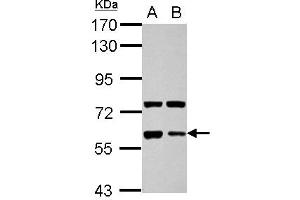 Western Blotting (WB) image for anti-Glypican 5 (GPC5) (AA 37-352) antibody (ABIN1498501) (GPC5 Antikörper  (AA 37-352))