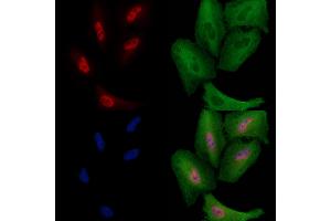 ABIN6259975 and ABIN6278551 staining  cells by IF/ICC. (CDC23 Antikörper  (Internal Region))