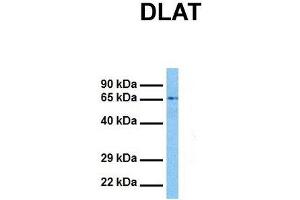Host:  Rabbit  Target Name:  DLAT  Sample Tissue:  Human Jurkat  Antibody Dilution:  1. (DLAT Antikörper  (N-Term))