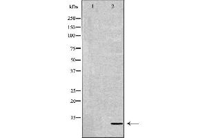Western blot analysis of Mouse liver lysate, using DEFB132 Antibody.