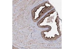Immunohistochemical staining of human prostate with SYTL1 polyclonal antibody  shows strong cytoplasmic and membranous positivity in glandular cells.