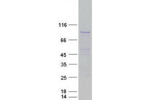 Western Blotting (WB) image for Histone Deacetylase 9 (HDAC9) (Transcript Variant 3) protein (Myc-DYKDDDDK Tag) (ABIN2722527)