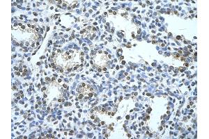 Rabbit Anti-SQLE Antibody       Paraffin Embedded Tissue:  Human neural cell   Cellular Data:  Epithelial cells of renal tubule  Antibody Concentration:   4.