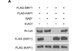 SIRT1 deacetylates KAP1 in vitro and in vivo. (Acetylated Lysine Antikörper)