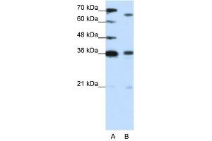PRDM13 antibody (20R-1222) used at 1. (PRDM13 Antikörper  (C-Term))