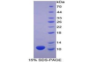 SDS-PAGE analysis of Human beta Thromboglobulin Protein.