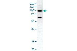 Western blot analysis of EPHA1 polyclonal antibody  in HeLa cell lysate. (EPHA1 Antikörper  (C-Term))