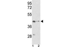 Western blot analysis of g-Actin antibody and (1) K562 and (2) HepG2 lysate (Actin, gamma 1 Antikörper  (AA 188-215))