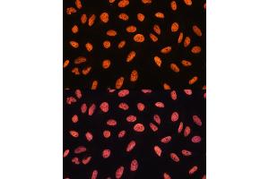 Immunofluorescence (IF) image for anti-Chromodomain Helicase DNA Binding Protein 4 (CHD4) (AA 1520-1690) antibody (ABIN6138512)