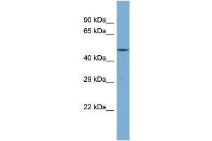 Western Blotting (WB) image for anti-G Protein-Coupled Receptor Kinase 5 (GRK5) (C-Term) antibody (ABIN2785867) (GRK5 Antikörper  (C-Term))