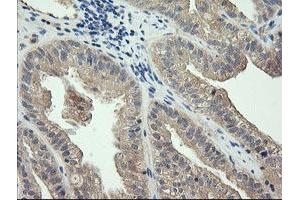 Image no. 2 for anti-Cancer/testis Antigen 1B (CTAG1B) antibody (ABIN1499892) (CTAG1B Antikörper)