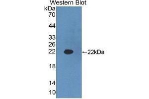 Detection of Recombinant HADH, Mouse using Polyclonal Antibody to Hydroxyacyl Coenzyme A Dehydrogenase (HADH) (HADH Antikörper  (AA 1-167))