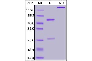 Anti-SARS-CoV-2 Nucleocapsid Antibody, Human IgG1 on SDS-PAGE under reducing (R) condition. (SARS-CoV-2 Nucleocapsid Antikörper)