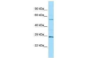 WB Suggested Anti-MINPP1 Antibody Titration: 1. (MINPP1 Antikörper  (C-Term))