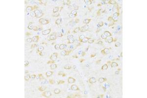 Immunohistochemistry of paraffin-embedded mouse brain using DDX3Y antibody (ABIN6130260, ABIN6139496, ABIN6139497 and ABIN6215395) at dilution of 1:100 (40x lens). (DDX3Y Antikörper  (AA 1-210))