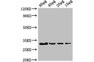 Western Blot Positive WB detected in: Rosseta bacteria lysate at 80 μg, 40 μg, 20 μg, 10 μg All lanes: eutC antibody at 3 μg/mL Secondary Goat polyclonal to rabbit IgG at 1/50000 dilution predicted band size: 32 kDa observed band size: 32 kDa (EUTC (AA 1-295) Antikörper)