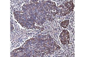IHC analysis of EGFR using anti-EGFR antibody (ABIN7599622). (EGFR Antikörper  (AA 1006-1210))