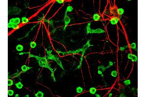 Mixed neuron glia cultures stain with INA antibody (red) and counterstained with rabbit polyclonal antibody to Coronin 1a, (green) which is an excellent marker of microglia and lymphocytes. (INA Antikörper)
