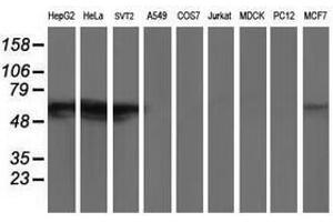 Image no. 2 for anti-Glucosidase, Beta, Acid 3 (Cytosolic) (GBA3) (AA 1-150), (AA 370-469) antibody (ABIN1490586) (GBA3 Antikörper  (AA 1-150, AA 370-469))