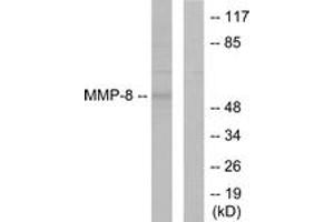 Western blot analysis of extracts from NIH-3T3 cells, using MMP-8 Antibody. (MMP8 Antikörper  (AA 418-467))