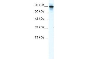 WB Suggested Anti-MCM2 Antibody Titration:  1. (MCM2 Antikörper  (N-Term))