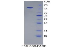 SDS-PAGE analysis of Human PSMC3 Protein. (PSMC3 Protein)