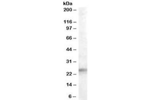 Western blot testing of human adrenal gland lysate with IGFBP6 antibody at 0. (IGFBP6 Antikörper)