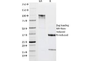 SDS-PAGE Analysis Purified HLA-DRA Mouse Monoclonal Antibody (IPO-10).